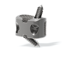 3D Printed Self-Stabilizing (Zero-Profile) Cervical Fusion System